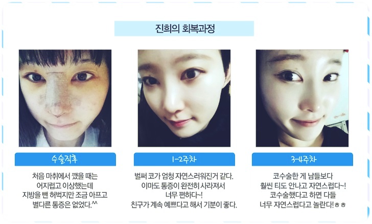 화곡역코수술 잘하는 곳으로 가볼까요? 관련 이미지 2