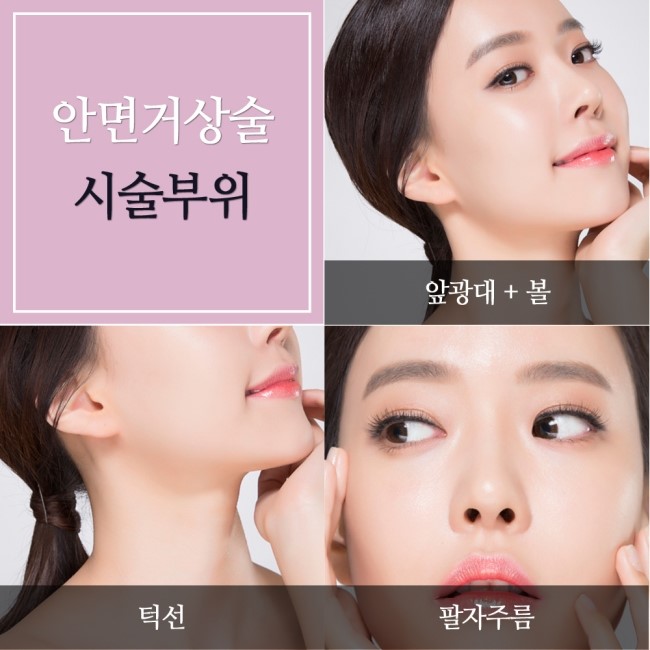 화곡역안면거상술 동안얼굴을 위한 확실한 방법! 관련 이미지 2