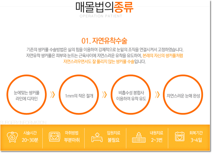목동쌍꺼풀수술잘하는곳 확실한 선택 관련 이미지 4