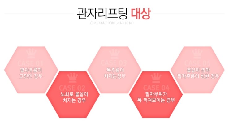 까치산역리프팅, 예전 모습으로 돌아가는 길 관련 이미지 2