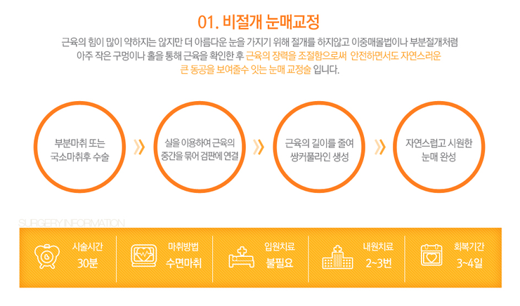 [까치산성형외과 로드성형외과에서 알려드리는 눈매교정 정보 ♬] 관련 이미지 4