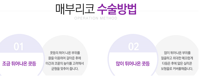 목동코성형잘하는곳 확인하세요 관련 이미지 3