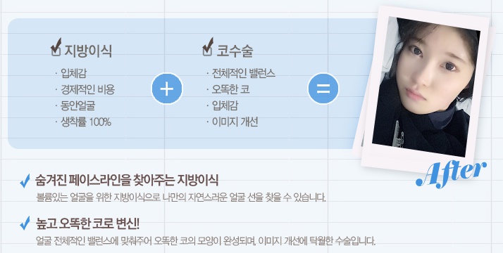 신정역코성형 잘하는 곳에서 라인 UP! 관련 이미지 4