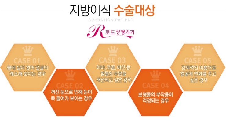화곡동지방이식 탄력을 더하기 관련 이미지 2