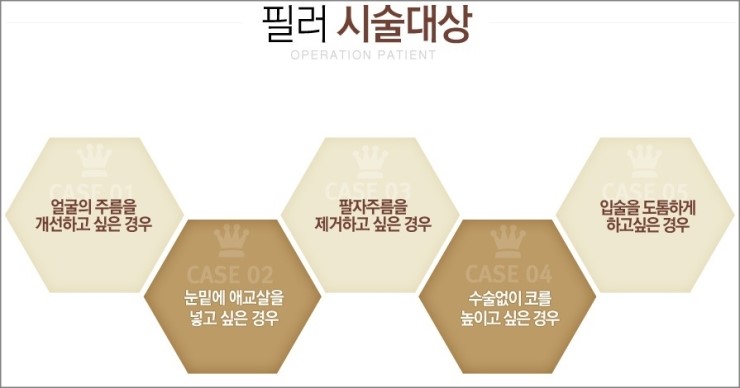 강서구코필러 부담없이 매끈하게 관련 이미지 2