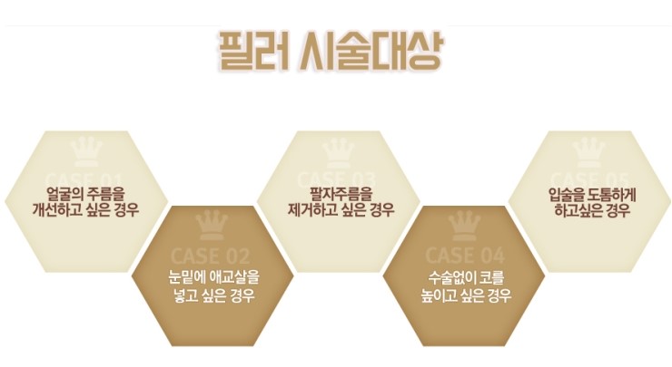 강서구눈밑필러 밝은 눈매 완성 관련 이미지 3