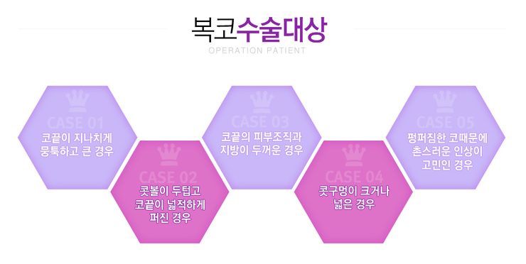 [까치산역성형외과 로드성형외과에서 알려드리는 복코성형 정보 ♬] 관련 이미지 2