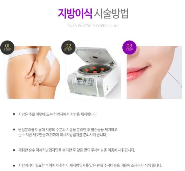 마곡지방이식 밋밋한 얼굴 고민이라면 관련 이미지 4