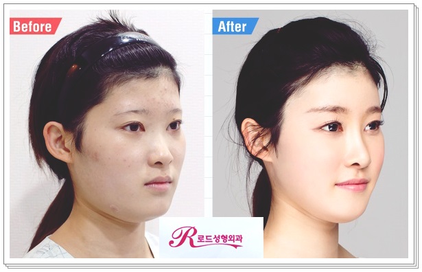 목동코재수술 내 모습을 되찾다 관련 이미지 2