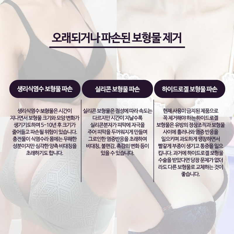 Breast Implant Removal Should Be Done Delicately and Accurately image 4