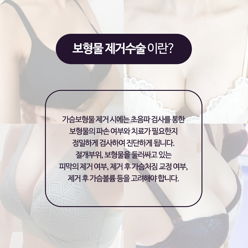 Breast Implant Removal Should Be Done Delicately and Accurately image 2