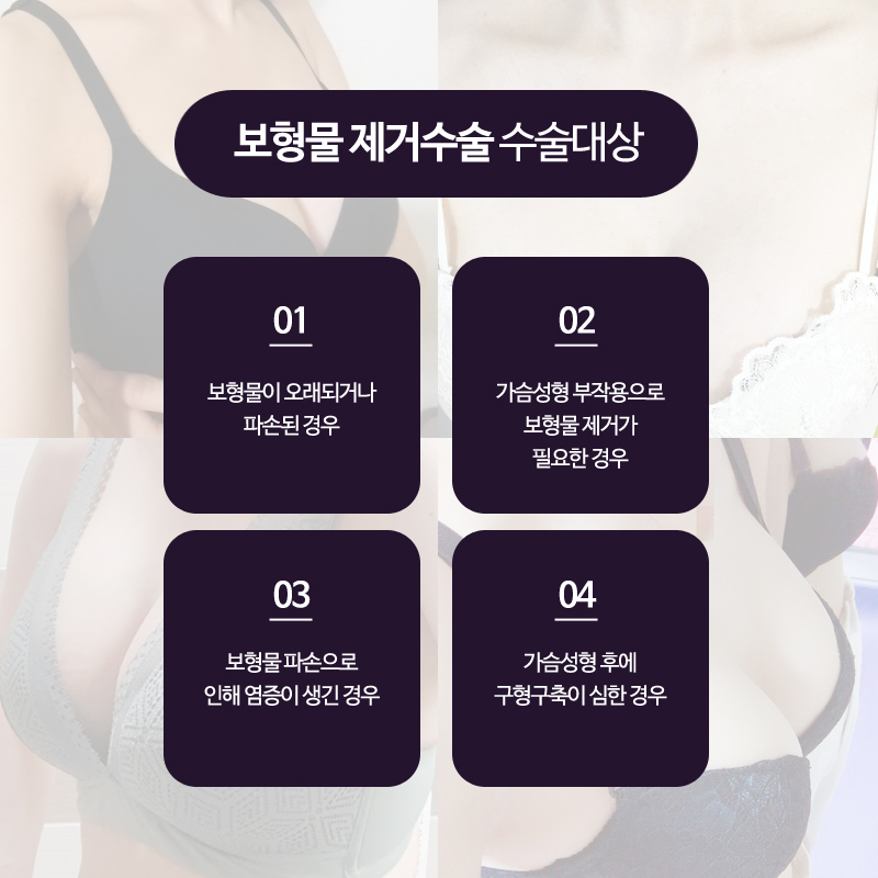 Breast Implant Removal Should Be Done Delicately and Accurately image 3