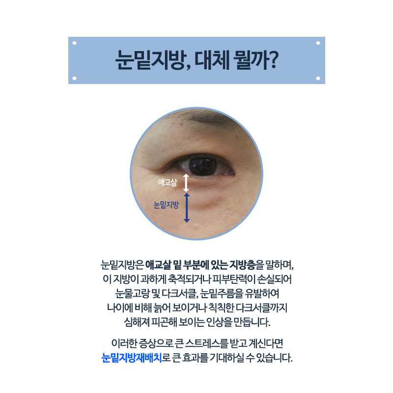 What Kind of Surgery Is Under-Eye Fat Repositioning? image 2