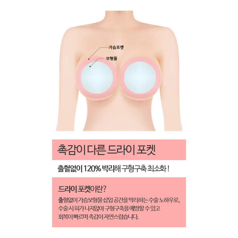 강남더블유성형외과 디자인 가슴성형이란? 관련 이미지 4