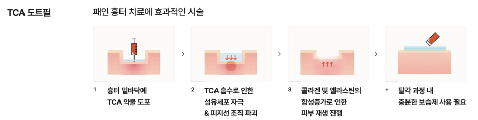 민감성 피부 로션 크림이 효과가 없던 이유 - 피부과 치료 사례 관련 이미지 10
