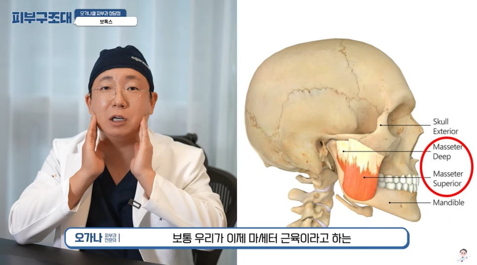 보톡스 내성 생기면 어쩌죠? 20년간 맞은 결과와 효과 관련 이미지 11