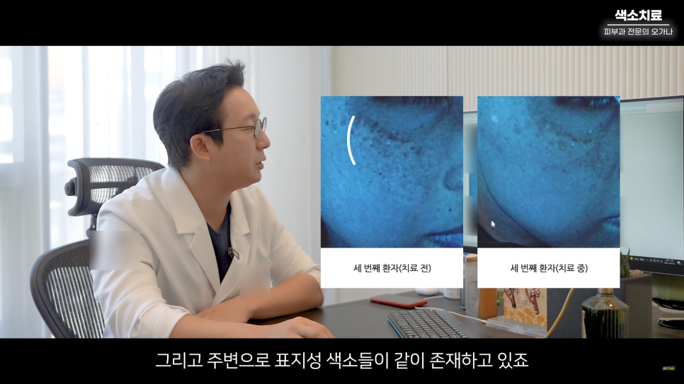 피부과 치료도 과유불급! 색소치료의 모든 것 #기미#색소병변#오타모반 | 오프라이드 오가나 관련 이미지 20