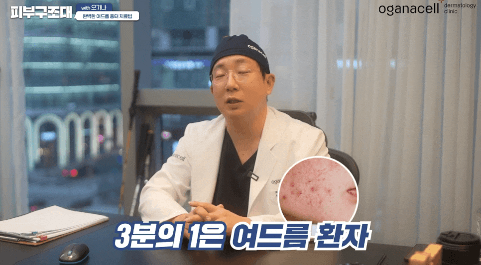 여드름 패인흉터 치료 방법 제대로알자 관련 이미지 3
