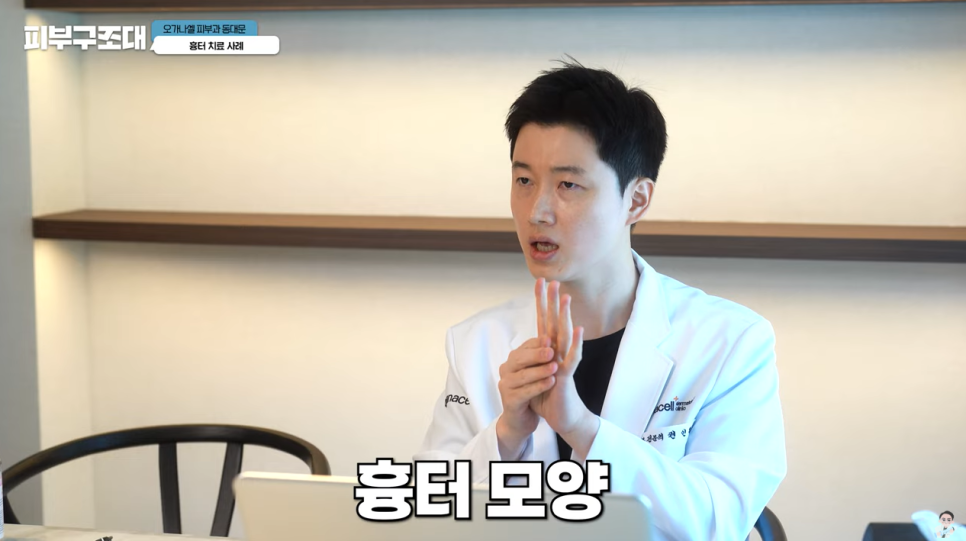 여드름 흉터 쥬베룩 어디까지 좋아질 수 있을까? 관련 이미지 4