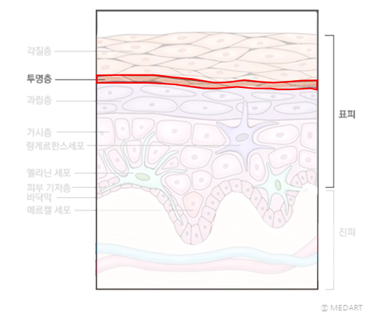 피부의 구조(표피, 진피, 피하조직) | 피부과전문의 오가나 관련 이미지 5