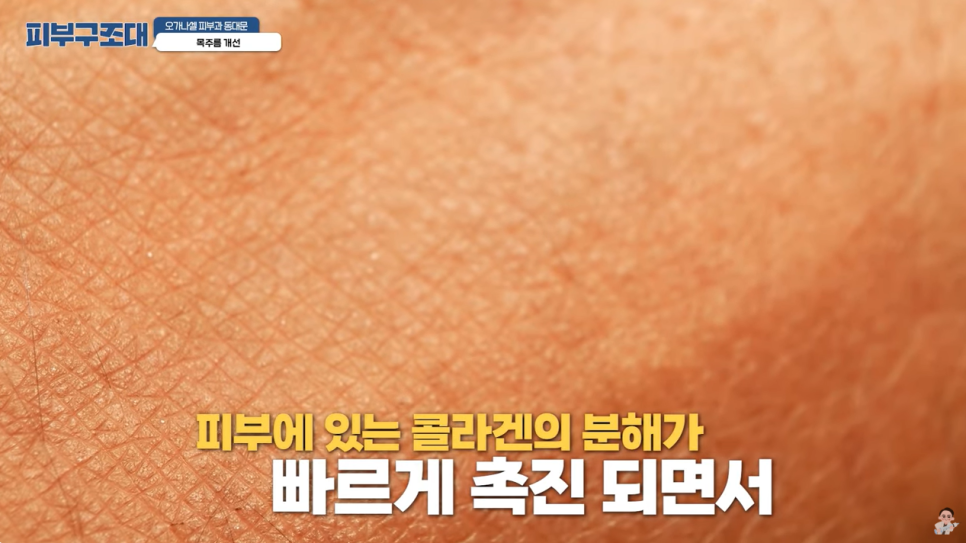 가로 목주름 관리 방법, 돈 들이지 않고 집에서도 가능할까? 관련 이미지 7