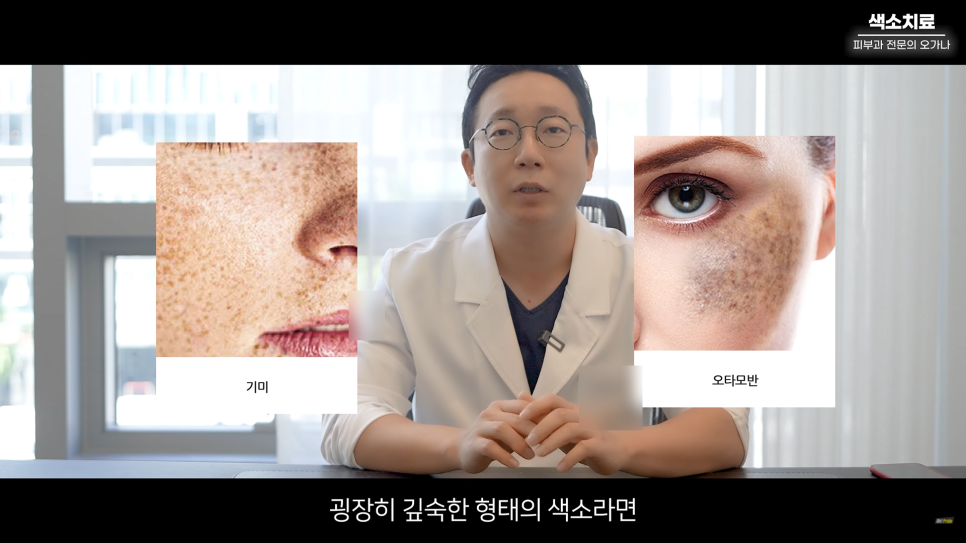 피부과 치료도 과유불급! 색소치료의 모든 것 #기미#색소병변#오타모반 | 오프라이드 오가나 관련 이미지 10