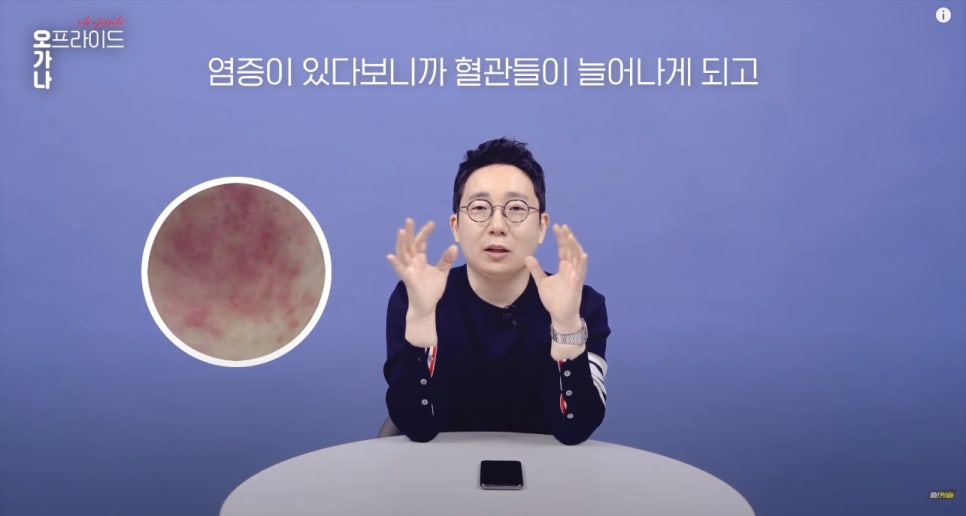 여드름 흉터 치료 가장 확실한 치료법 알려드립니다! | 피부과전문의 오가나 관련 이미지 7