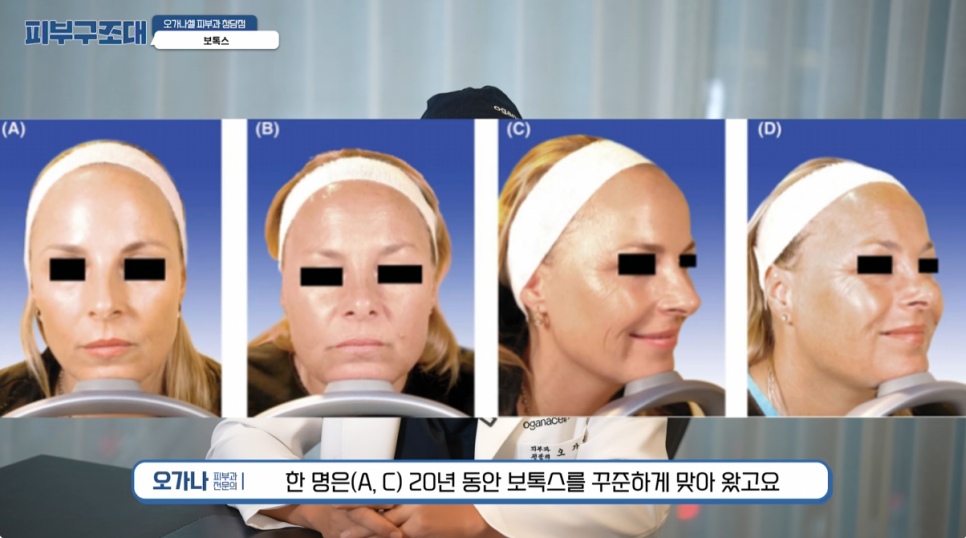 The Secret of Twins Who Haven’t Aged for 20 Years (feat. Before-and-After Botox Photos Revealed) image 1
