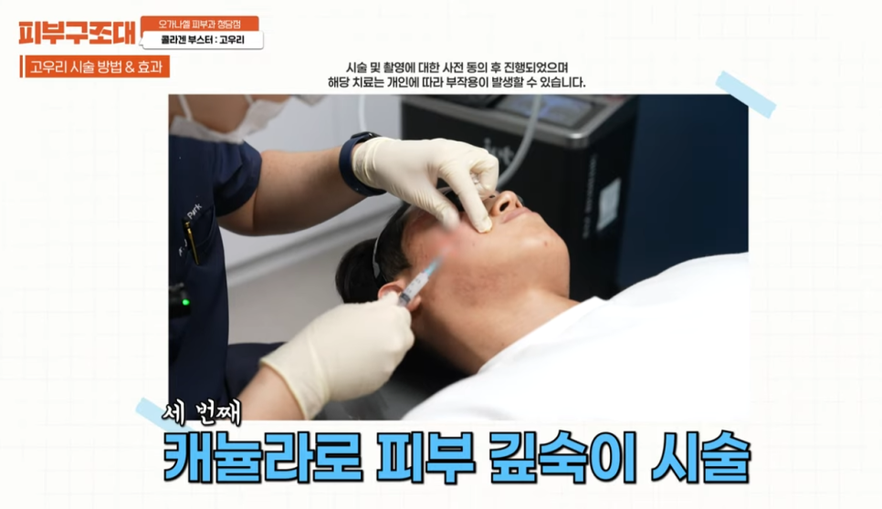 3세대 스킨부스터 등장(feat. 고우리 첫 사용 리뷰) 관련 이미지 7