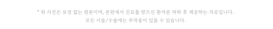 얼굴 색소침착 치료 가격만 보고 선택하면 후회합니다 관련 이미지 7