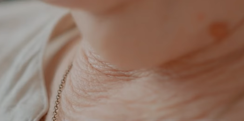 가로 목주름 관리 방법, 돈 들이지 않고 집에서도 가능할까? 관련 이미지 2
