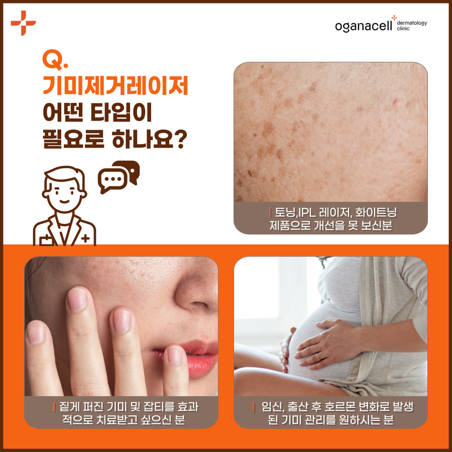 기미제거레이저 토닝 유명한곳 가격은 관련 이미지 5