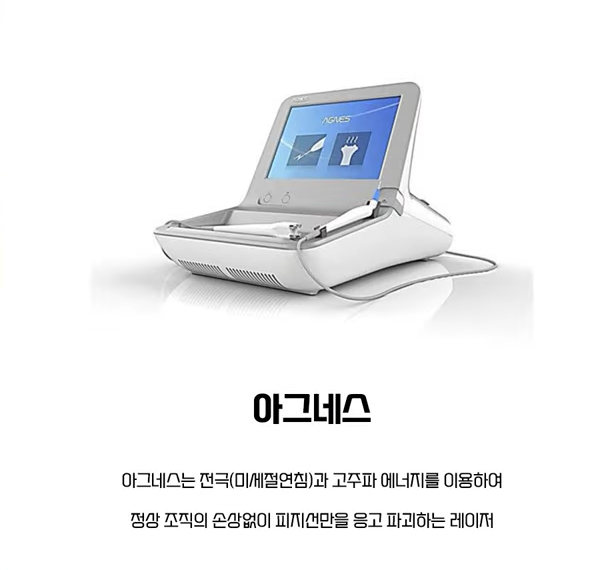 좁쌀 여드름 레이저 시술 전 필독! 이거 알고 받으세요! 관련 이미지 10