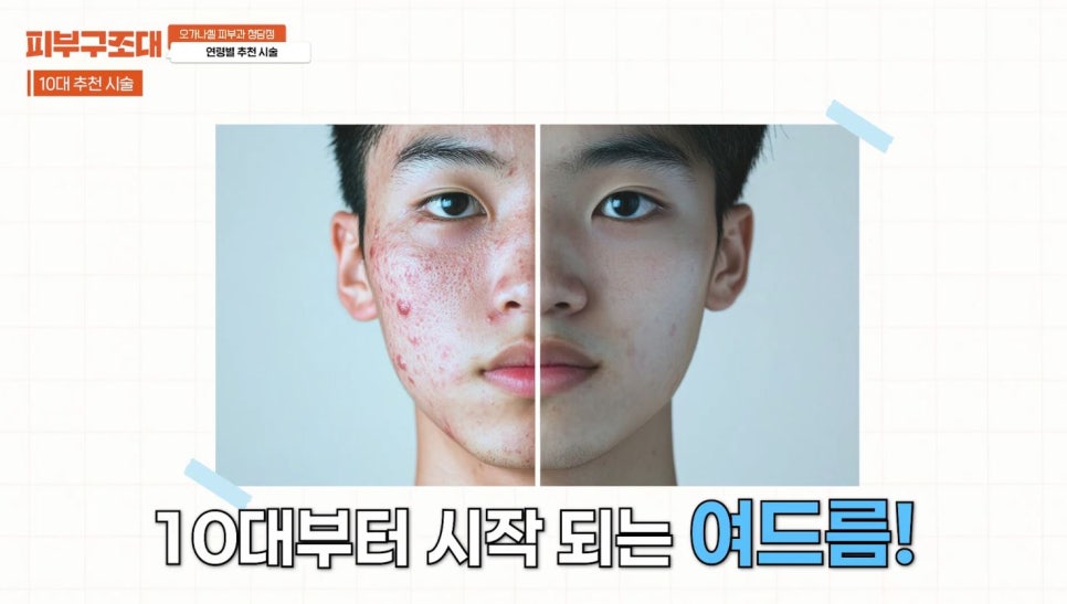 Recommended Procedures by Age Group from Teens to 60s (feat. Don’t Waste Money on Your Skin) image 2