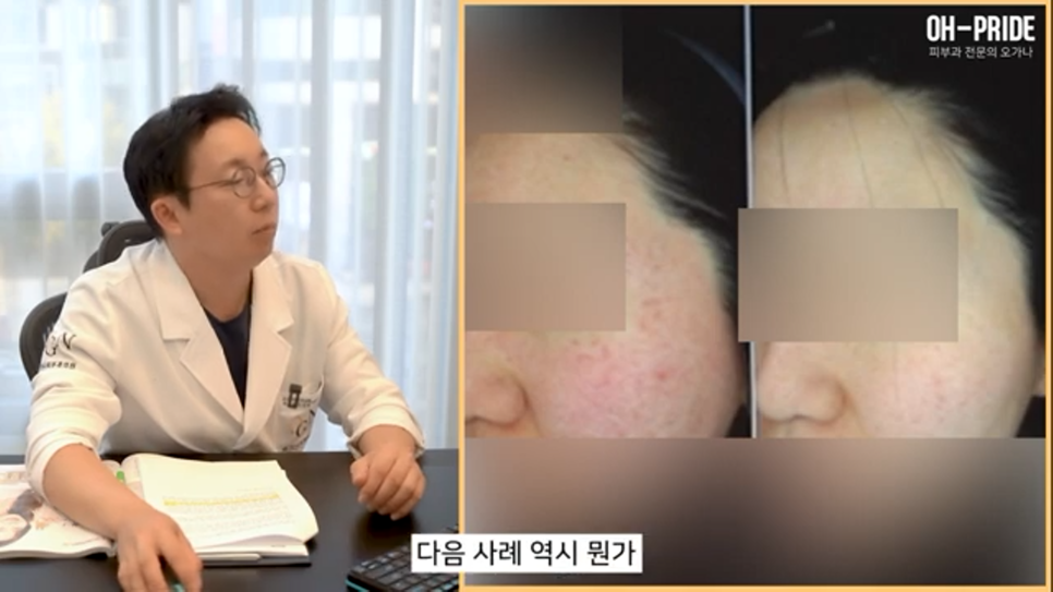 내 얼굴의 적신호 겨울철 안면 홍조! 관련 이미지 8
