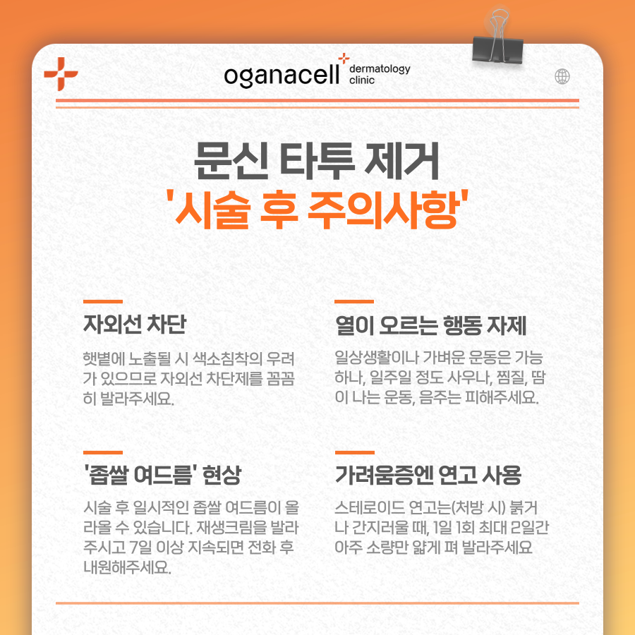 타투지우기 제거 깔끔하게 받으려면 관련 이미지 16