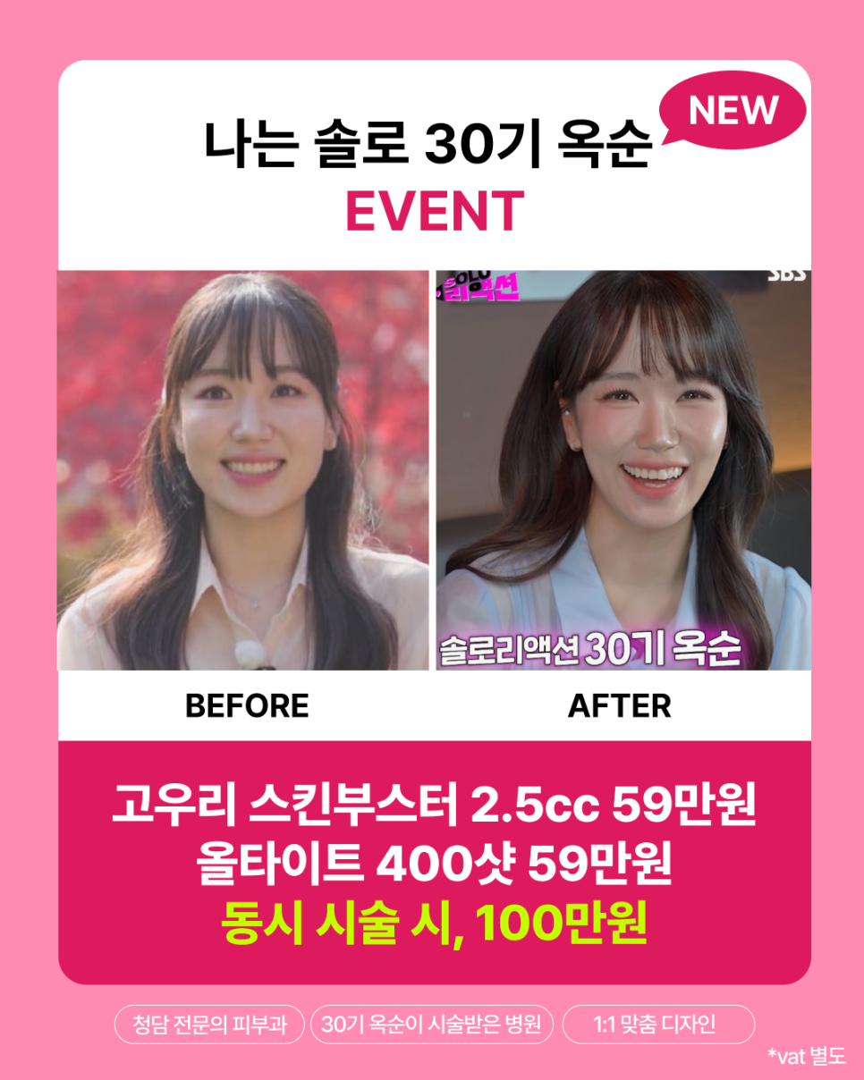 나는솔로 30기 옥순님 리프팅, 제가 직접 해드렸습니다. (feat. 올타이트, 고우리) 관련 이미지 4