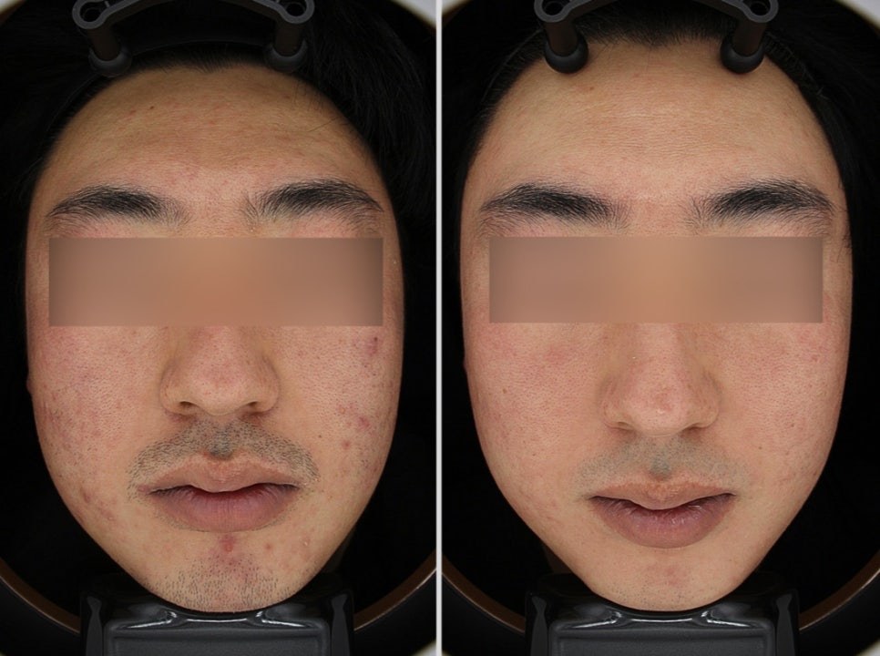강남구청피부과? 더 이상 고민하지 마세요 관련 이미지 3