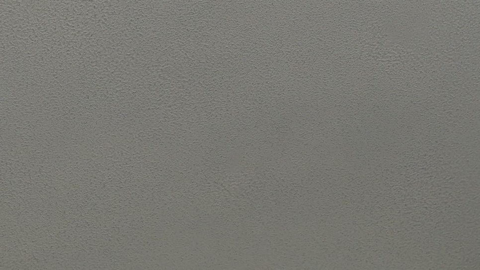 민감성 피부 로션 크림이 효과가 없던 이유 - 피부과 치료 사례 관련 이미지 28