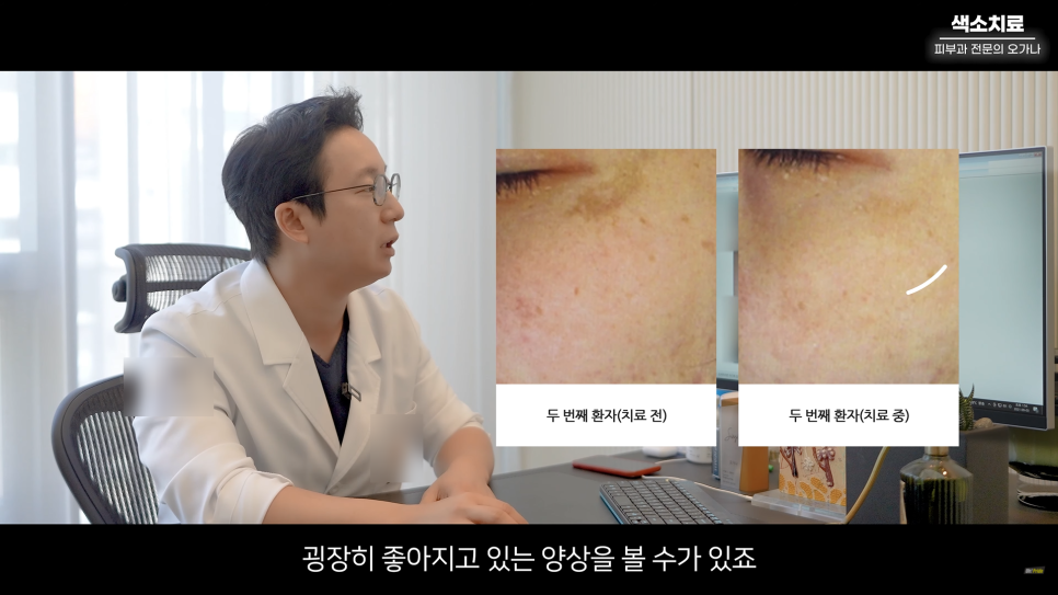 피부과 치료도 과유불급! 색소치료의 모든 것 #기미#색소병변#오타모반 | 오프라이드 오가나 관련 이미지 19