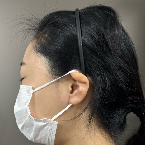이마 필러 꼭 2가지는 체크해 보시길 당부드립니다. 관련 이미지 3