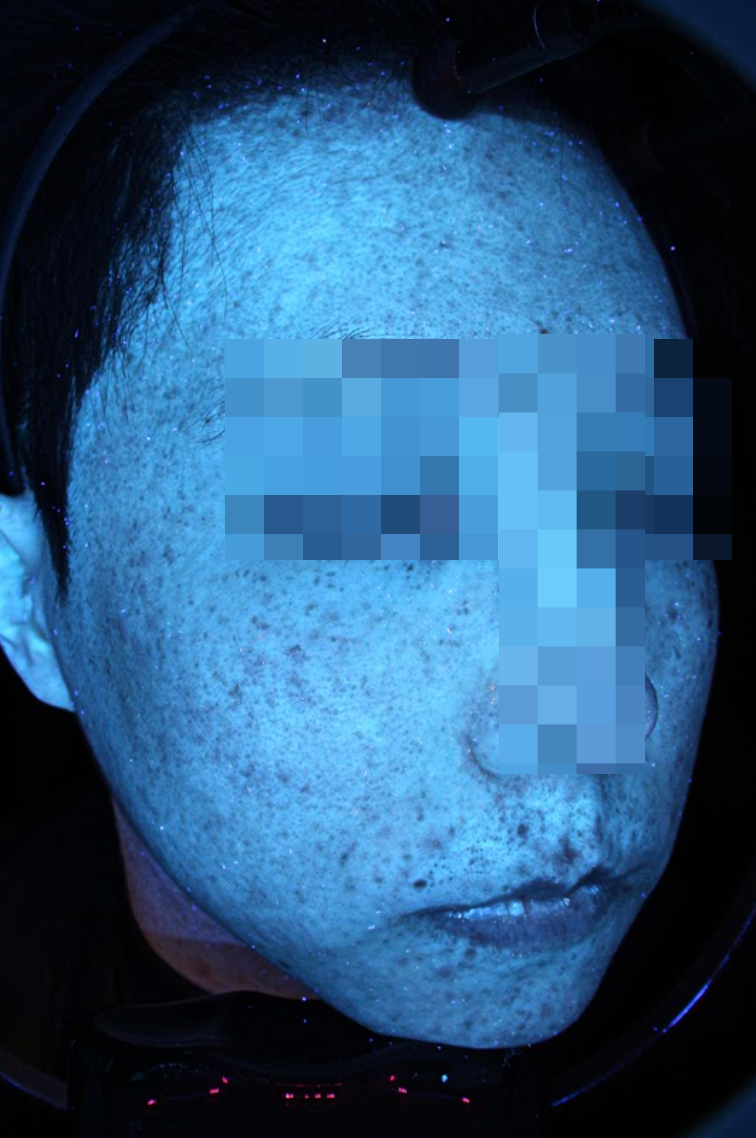 피부장벽 개선, 치료만큼 중요한건 00입니다 관련 이미지 3