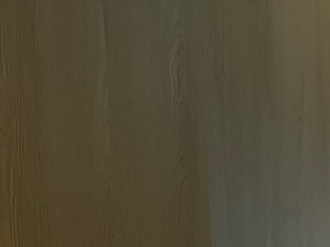 온다 리프팅, 통증에 민감한 분들을 위한 선택지 관련 이미지 25