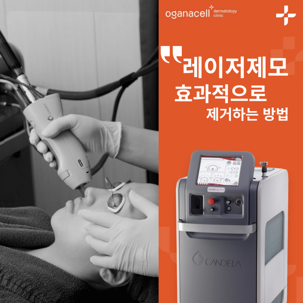 강남레이저제모 젠틀맥스프로 통증 얼마나? 관련 이미지 1