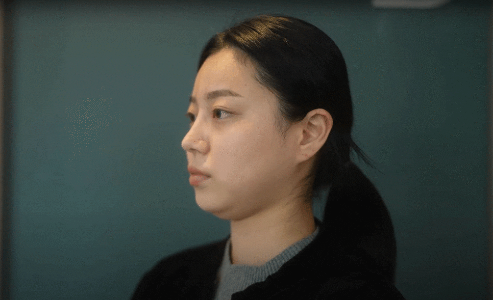 요즘 대세 리프팅 온다(onda) 원리,성능 / 정리 관련 이미지 10