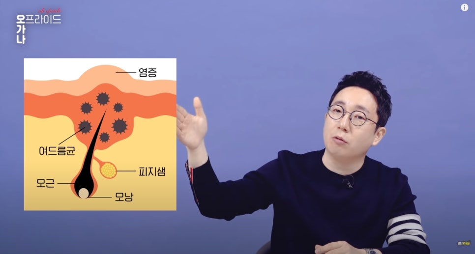 여드름 흉터 치료 가장 확실한 치료법 알려드립니다! | 피부과전문의 오가나 관련 이미지 3