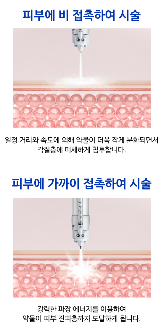 큐어젯 쥬베룩 흉터 치료 부작용에 대한 오해 - 전문의 작성 관련 이미지 4