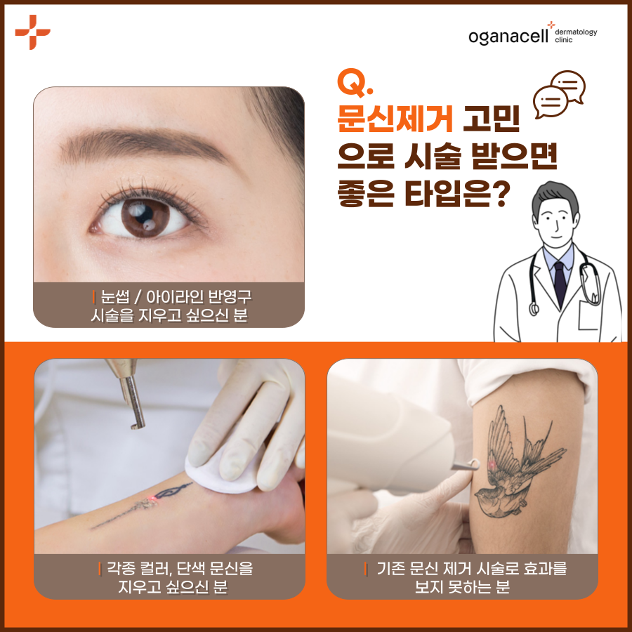 타투지우기 제거 깔끔하게 받으려면 관련 이미지 4