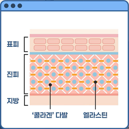 얼굴에 하얀 버짐, 겨울철 튼살 관리 이렇게 하세요! 관련 이미지 5
