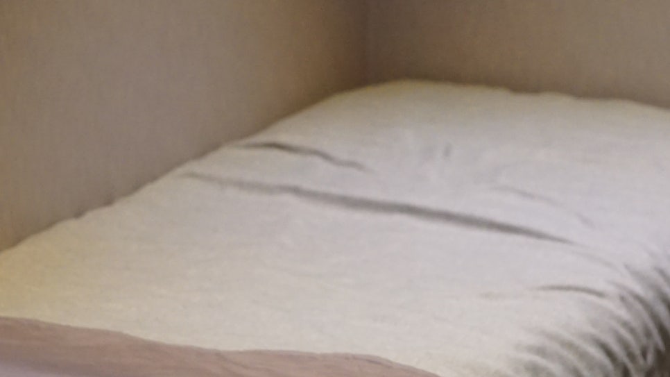 얼굴 실리프팅, 이런 분이 받으셔야 해요 관련 이미지 15